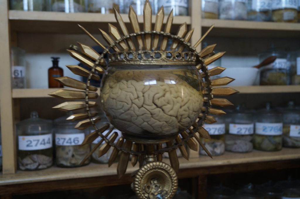 El Museo de Patologías Neurológicas alberga más de 2000 cerebros, de los cuales solo alrededor de 200 están en exhibición.